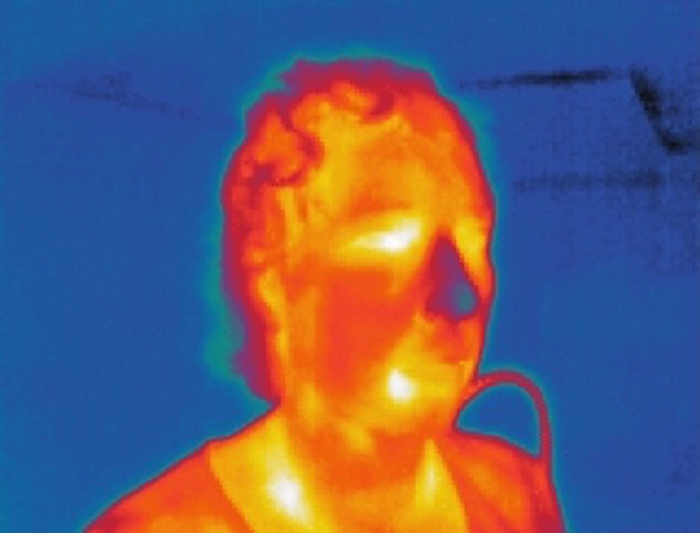thermal portrait
